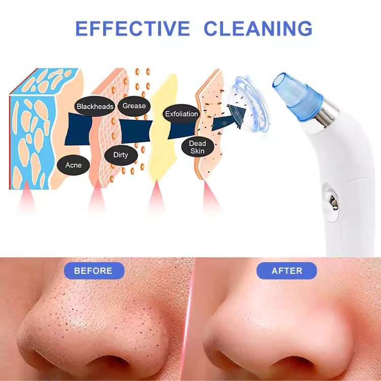 4 in 1 Multi-Function Acne Blackhead Pimple Pore Cleaner Vacuum Tool