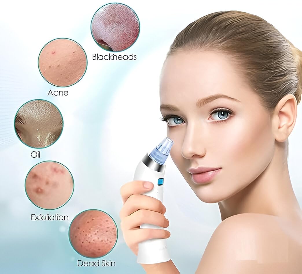 4 in 1 Multi-Function Acne Blackhead Pimple Pore Cleaner Vacuum Tool